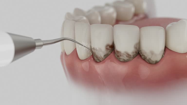 Trusted Emergency Dentist service in Fairborn, OH - Dentist Open Now